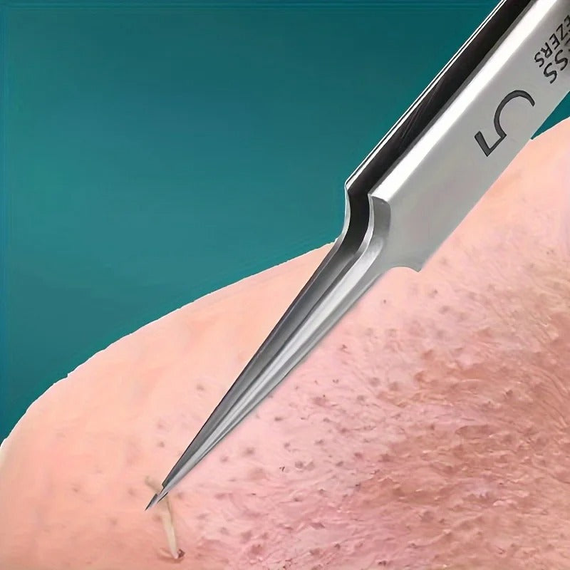 Best Acne & Blackhead Extraction Kit in USA