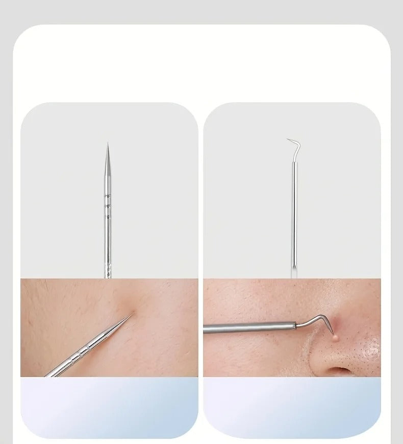 Best Acne & Blackhead Extraction Kit in USA