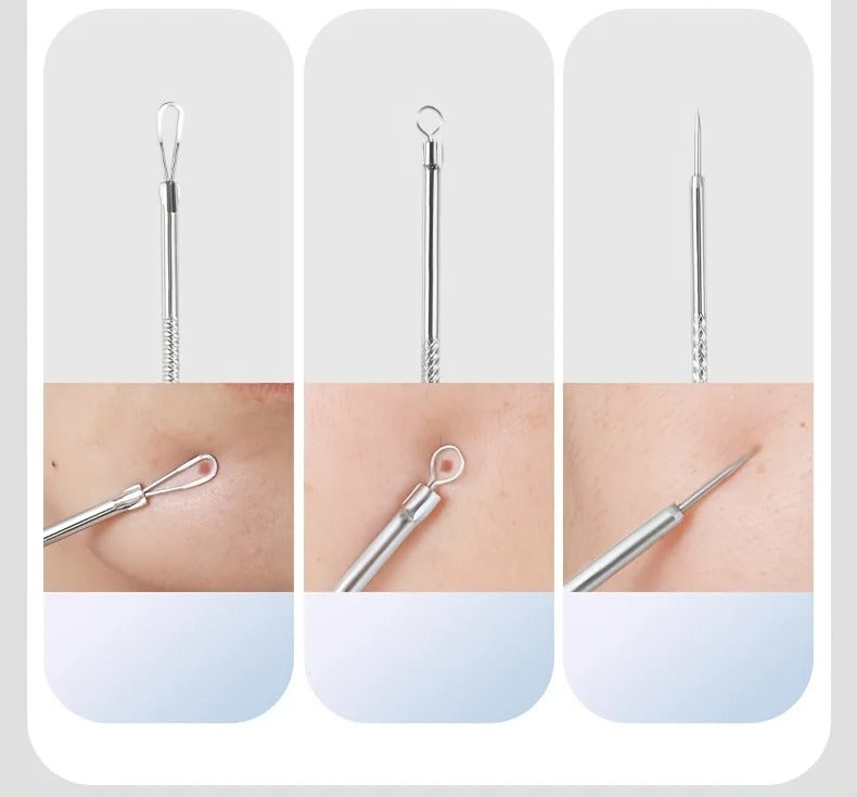 Best Acne & Blackhead Extraction Kit in USA