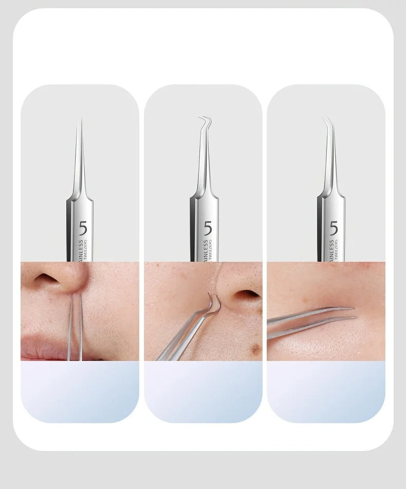Best Acne & Blackhead Extraction Kit in USA